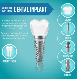 Free Dental Implant Consultation Burlington Dental
